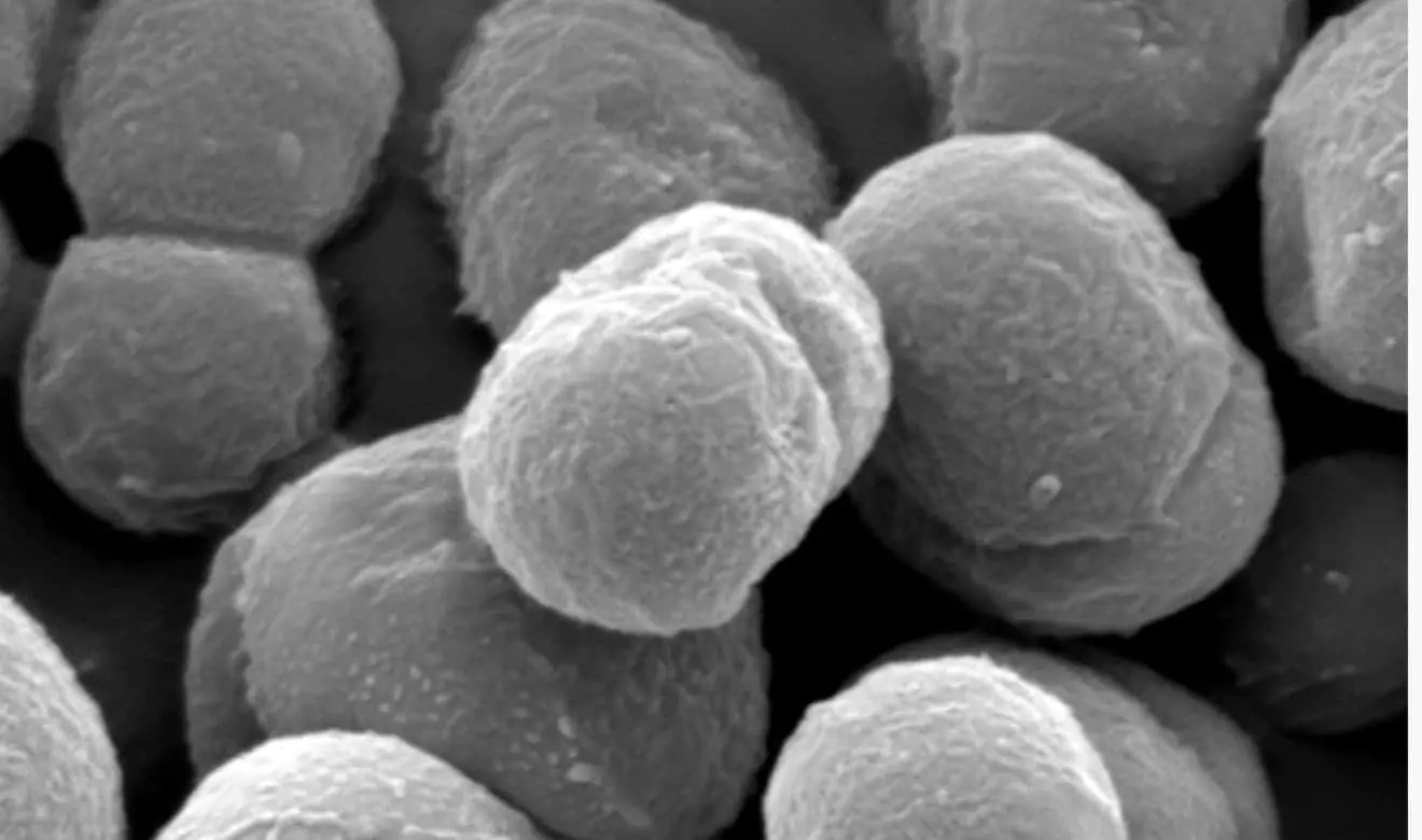 Deinococcus radiodurans